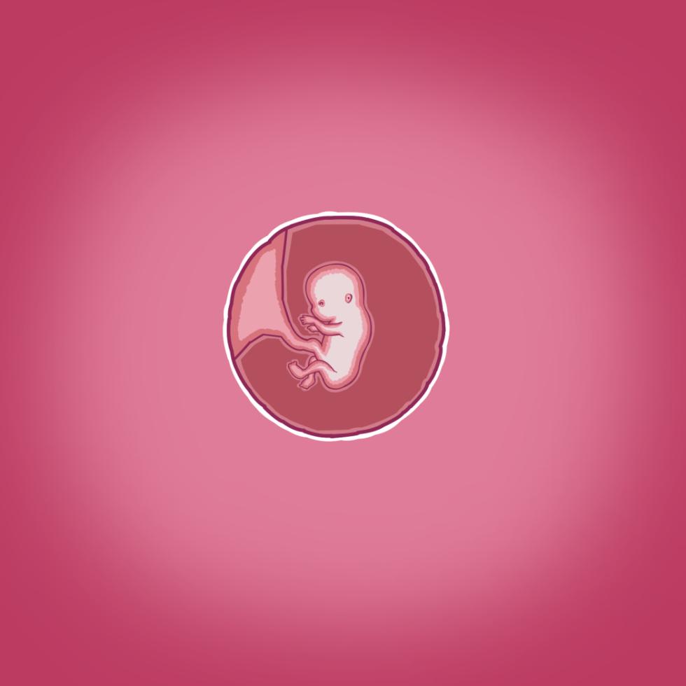 [Straw] Yumi's Study Abroad/由美的留学生活（汉化）（连载中） - Page 36