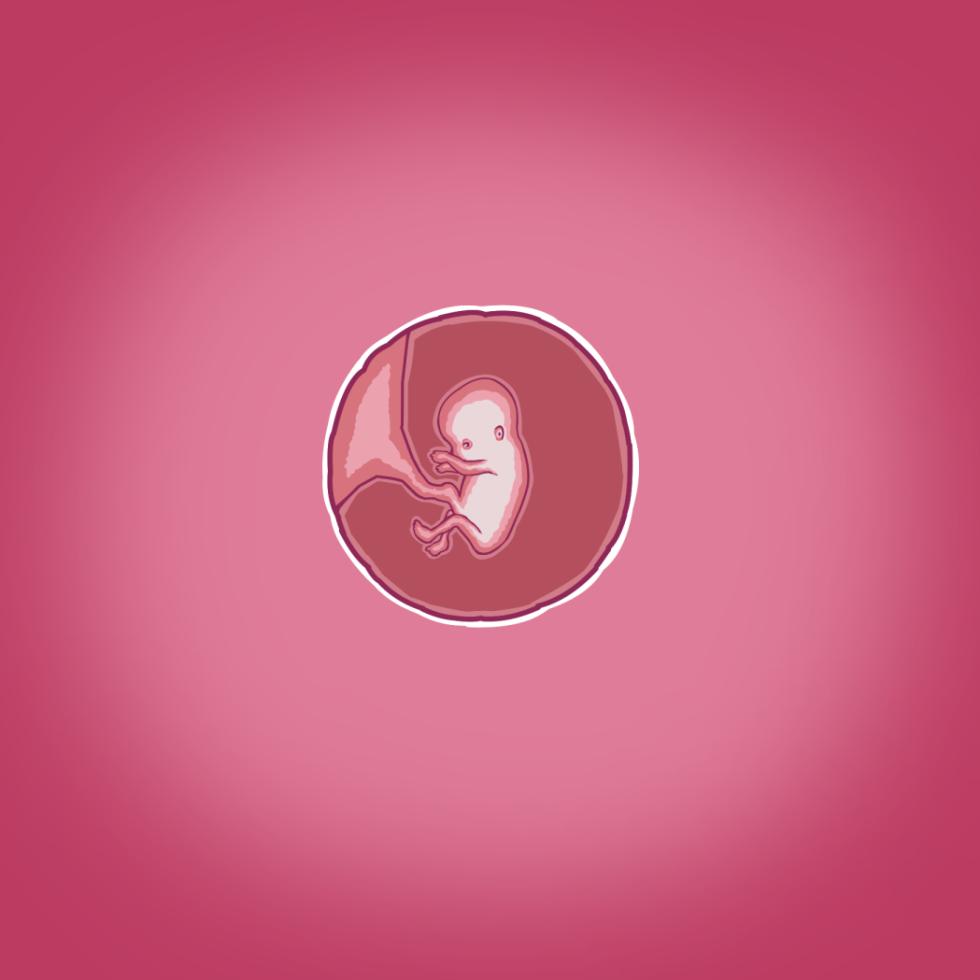 [Straw] Yumi's Study Abroad/由美的留学生活（汉化）（连载中） - Page 31