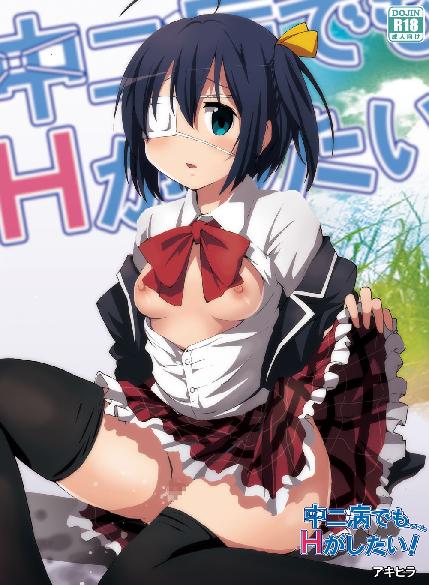 [Studio Nunchaku (Akihira)] Chuunibyou demo Ecchi ga Shitai! (Chuunibyou Demo Koi ga Shitai!) [Digital] - Page 1