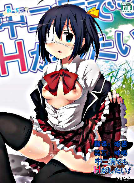 [Studio Nunchaku (Akihira)] Chuunibyou demo Ecchi ga Shitai! (Chuunibyou Demo Koi ga Shitai!) [Chinese] [脸肿汉化组]  [Digital] - Page 1