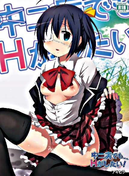 [Studio Nunchaku (Akihira)] Chuunibyou demo Ecchi ga Shitai! (Chuunibyou Demo Koi ga Shitai!) [Chinese] [脸肿汉化组]  [Digital] - Page 2