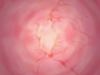 [Bingo Tarte] Pretty Predot Honpen Chuuhen - Honban Rape!- - Page 31